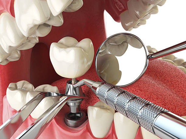 Best Tooth Pain Emergency Relief  in Merrillville, IN