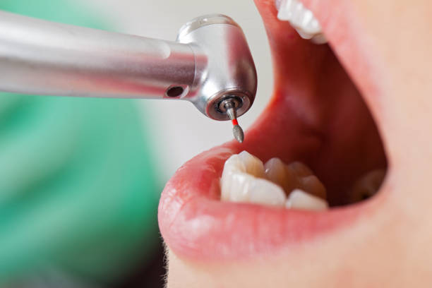 Best Knocked-Out Tooth Emergency  in Merrillville, IN